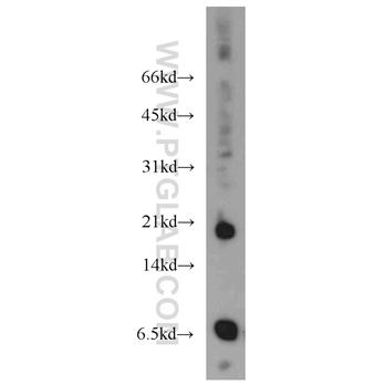 CCL11 Rabbit Polyclonal Antibody (11786-1-AP)