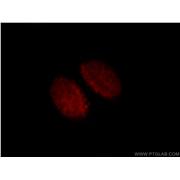 CUX1 Rabbit Polyclonal Antibody (11733-1-AP)