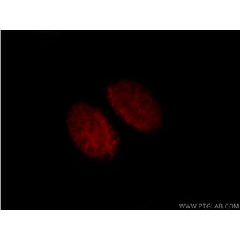 CUX1 Rabbit Polyclonal Antibody (11733-1-AP)
