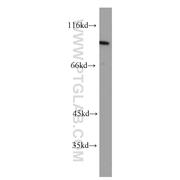 PTPN22 Rabbit Polyclonal Antibody (11783-1-AP)