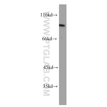 PTPN22 Rabbit Polyclonal Antibody (11783-1-AP)