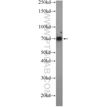 C4BPA Rabbit Polyclonal Antibody (11819-1-AP)