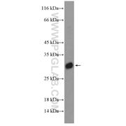 DIO1 Rabbit Polyclonal Antibody (11790-1-AP)