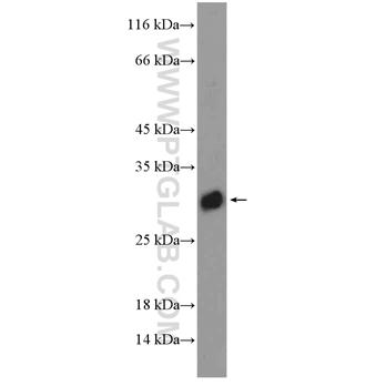 DIO1 Rabbit Polyclonal Antibody (11790-1-AP)
