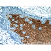 CRNN Rabbit Polyclonal Antibody (11799-1-AP)