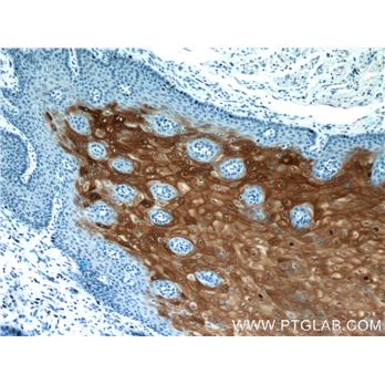 CRNN Rabbit Polyclonal Antibody (11799-1-AP)