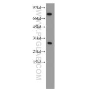 CBX5 Rabbit Polyclonal Antibody (11831-1-AP)