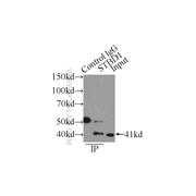 STBD1 Rabbit Polyclonal Antibody (11842-1-AP)