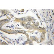 SSNA1 Rabbit Polyclonal Antibody (11797-1-AP)