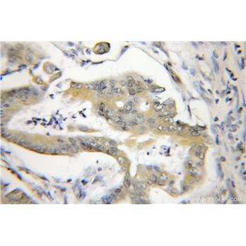 SSNA1 Rabbit Polyclonal Antibody (11797-1-AP)