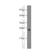 MYF6 Rabbit Polyclonal Antibody (11754-1-AP)