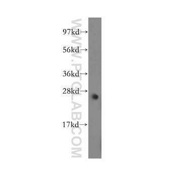 MYF6 Rabbit Polyclonal Antibody (11754-1-AP)
