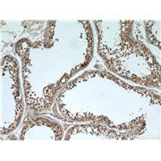 OSBPL9 Rabbit Polyclonal Antibody (11879-1-AP)