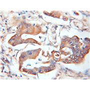 ASB8 Rabbit Polyclonal Antibody (11735-1-AP)