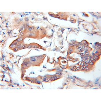 ASB8 Rabbit Polyclonal Antibody (11735-1-AP)