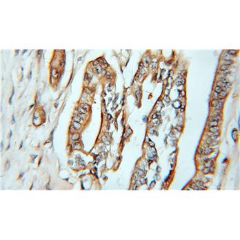 CASP4 Rabbit Polyclonal Antibody (11856-1-AP)
