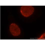 HNRNPC Rabbit Polyclonal Antibody (11760-1-AP)