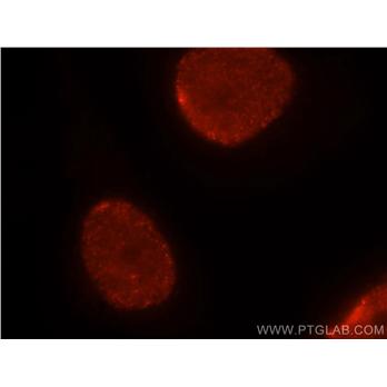 HNRNPC Rabbit Polyclonal Antibody (11760-1-AP)