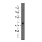 TWF1 Rabbit Polyclonal Antibody (11732-1-AP)