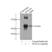 SPATA6 Rabbit Polyclonal Antibody (11849-1-AP)