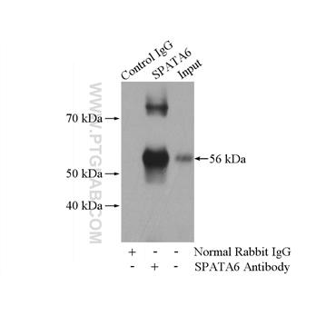 SPATA6 Rabbit Polyclonal Antibody (11849-1-AP)