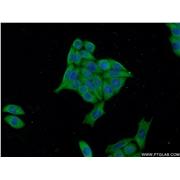 S100P Rabbit Polyclonal Antibody (11803-1-AP)