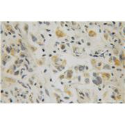 RAB10 Rabbit Polyclonal Antibody (11808-1-AP)