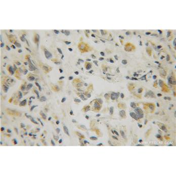 RAB10 Rabbit Polyclonal Antibody (11808-1-AP)