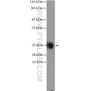 IGKV1-5 Rabbit Polyclonal Antibody (11781-1-AP)