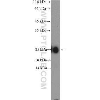IGKV1-5 Rabbit Polyclonal Antibody (11781-1-AP)