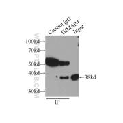 GIMAP4 Rabbit Polyclonal Antibody (11852-1-AP)