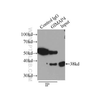 GIMAP4 Rabbit Polyclonal Antibody (11852-1-AP)