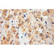 SEPT8 Rabbit Polyclonal Antibody (11769-1-AP)