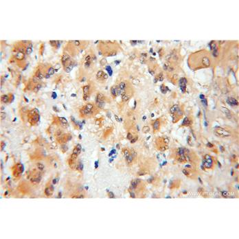 SEPT8 Rabbit Polyclonal Antibody (11769-1-AP)