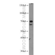 NFIA Rabbit Polyclonal Antibody (11750-1-AP)