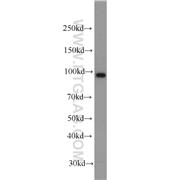 CILP2 Rabbit Polyclonal Antibody (11813-1-AP)