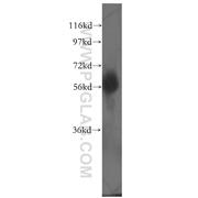 DCLRE1C Rabbit Polyclonal Antibody (11747-1-AP)