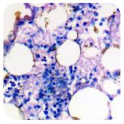 Giemsa Stain Kit (May-Grunwald)