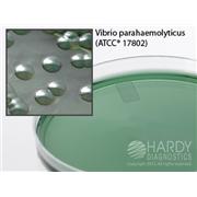 TCBS (Thiosulfate Citrate Bile Sucrose) Agar
