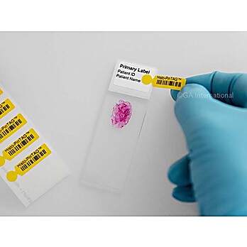 Removeable Thermal-Transfer Labels for Microscope Slide Re-Identification (Patent Pending)