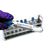 cf-DNA/cf-RNA Preservative Tubes