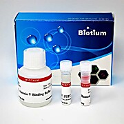 Apoptosis & Necrosis Quantification Kit (50 assays)