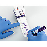 Cryogenic Writable Labels