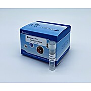 Probe Based 2x qPCR Master Mix