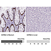 Anti-LAMA1 Recombinant Antibody