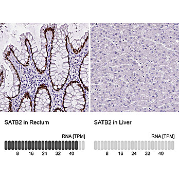 Anti-LAMA1 Recombinant Antibody 