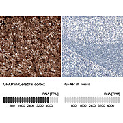 Anti-PAX2 Recombinant Antibody