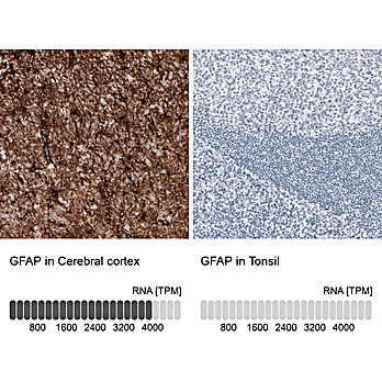 Anti-PAX2 Recombinant Antibody 