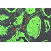 WGA (Wheat Germ Agglutinin)  Lectin