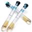 Vacutainer® Mononuclear Cell Preparation Tubes (CPT™ Tubes)